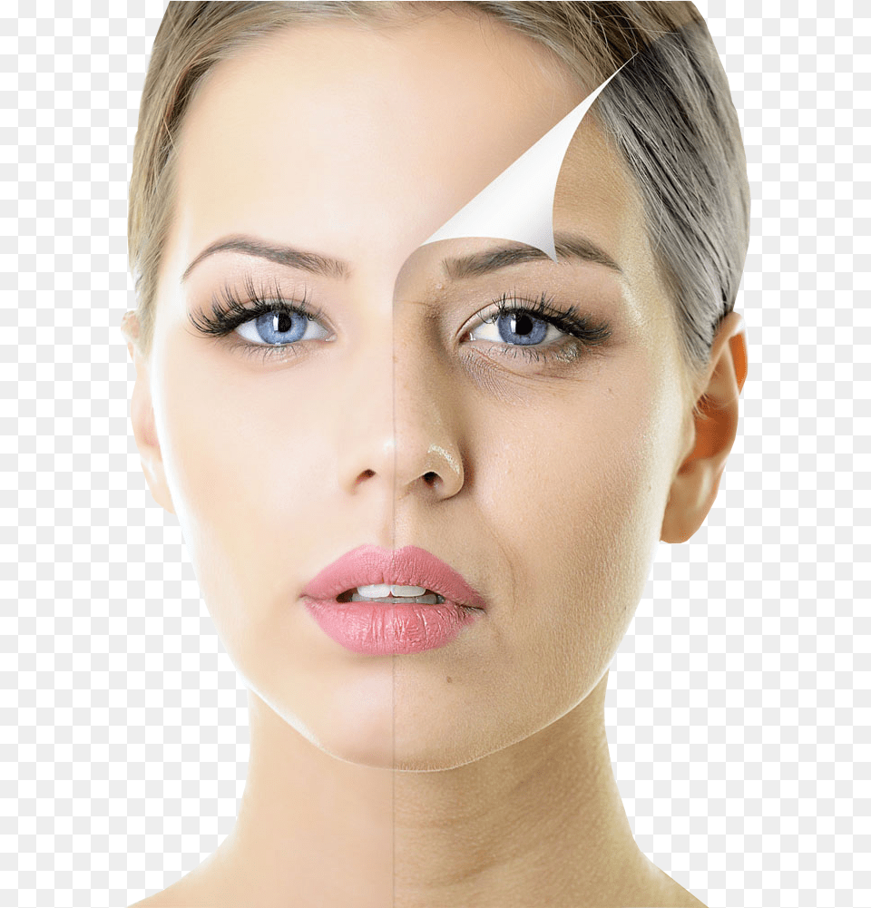 Beautiful Woman With Half Face Spotty Skin Download, Adult, Person, Head, Female Free Transparent Png