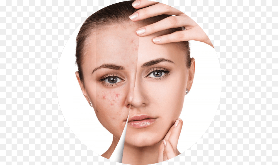 Beauty Face Before And After, Adult, Female, Head, Person Png