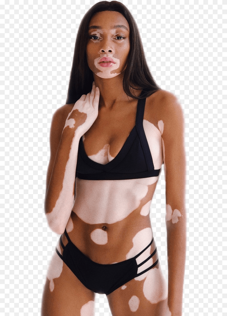 Beauty Model Winnieharlow Modeling Bikini Swimsuit Whitney Harlow, Swimwear, Clothing, Adult, Person Free Transparent Png