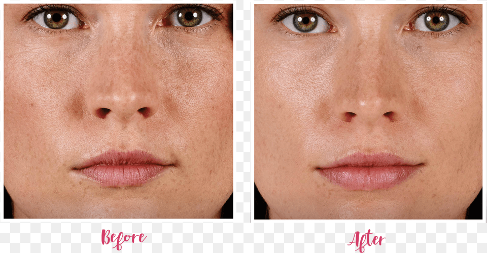 Before And After, Art, Collage, Face, Person Free Png Download