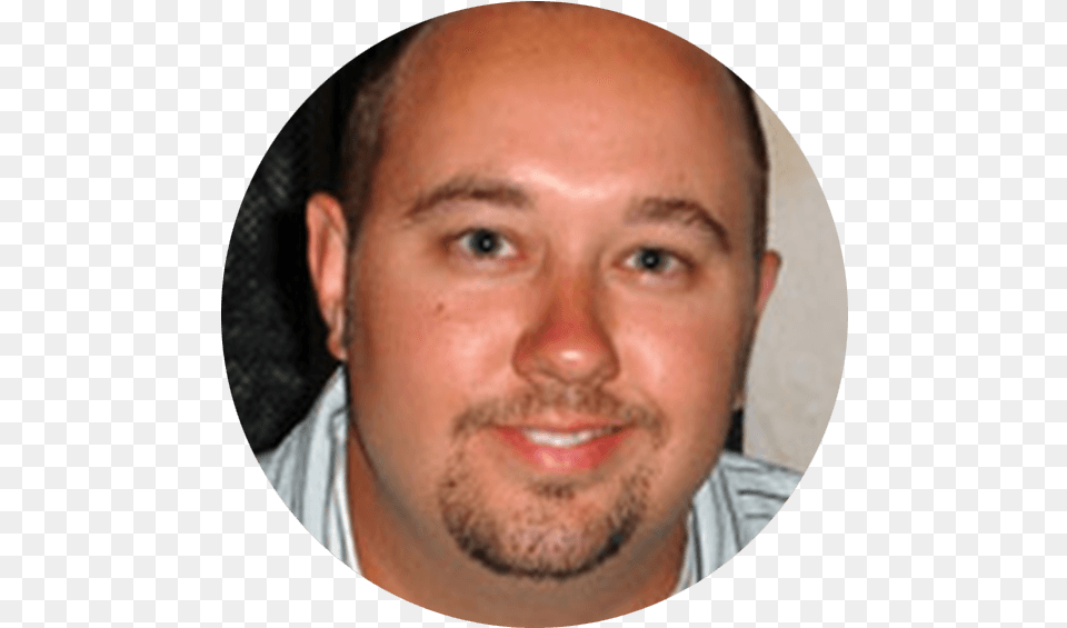 Ben Hair Loss, Adult, Face, Head, Male Free Png Download
