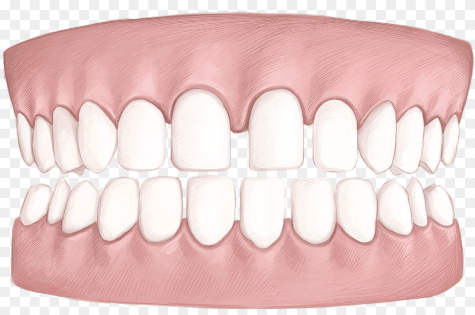 Bench, Body Part, Mouth, Person, Teeth Free Transparent Png