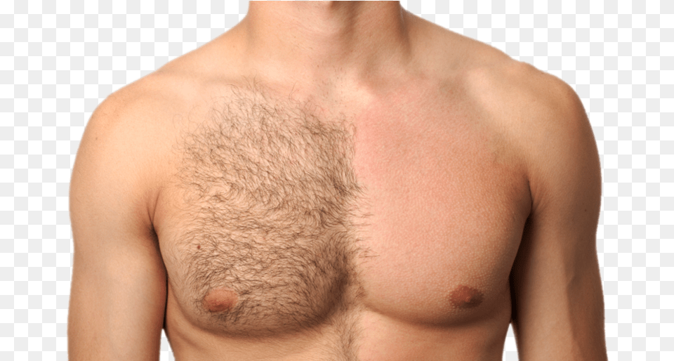 Best Hair Reduction Treatment In Bangalore And Hyderabad Men Trimming Body Hair, Skin, Person, Adult, Man Free Png