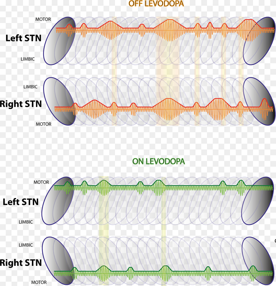 Beta Burst Dynamics In Parkinson39s Disease Off And Oval, Food Free Png Download