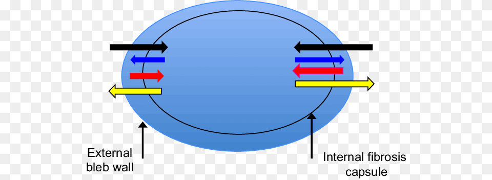 Bleb Needling Was Performed With A 30 Guage Needle Circle, Sphere, Hot Tub, Tub Free Png Download