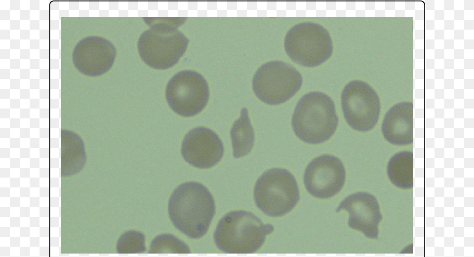 Blood Smear, Computer, Electronics, Laptop, Pc Free Png