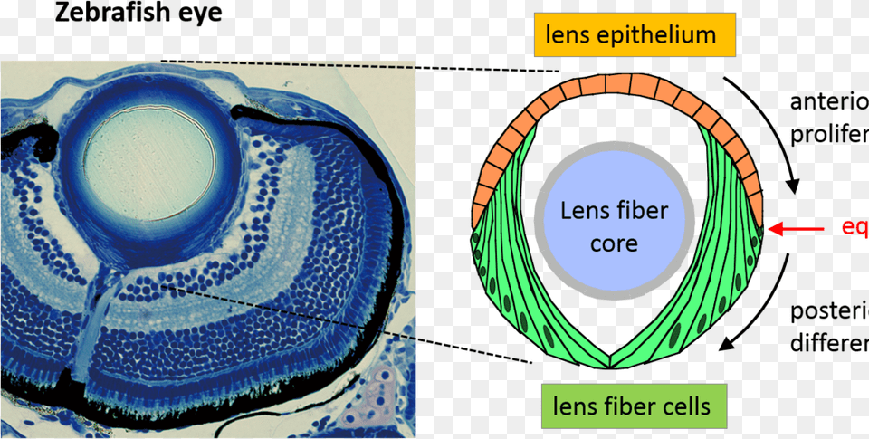 Blue Eye Lens, Ct Scan, Accessories, Disk Free Transparent Png