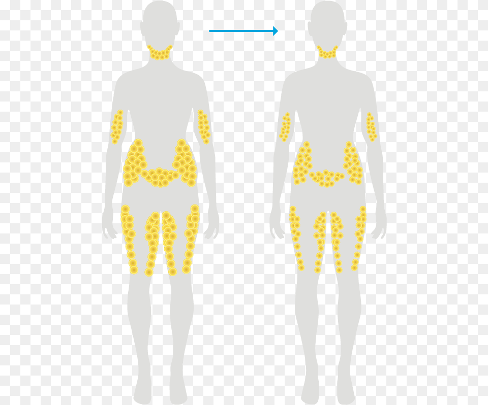 Body Fat Dissolving Injections, Chart, Plot, Adult, Male Free Transparent Png