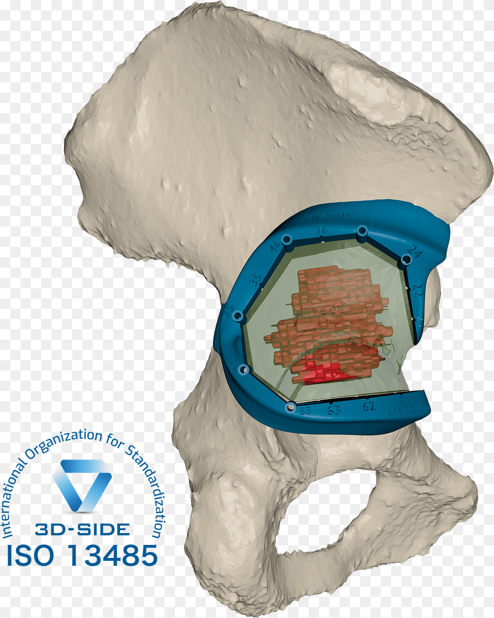 Bone Tumor Resection Illustration, Accessories, Goggles Png Image