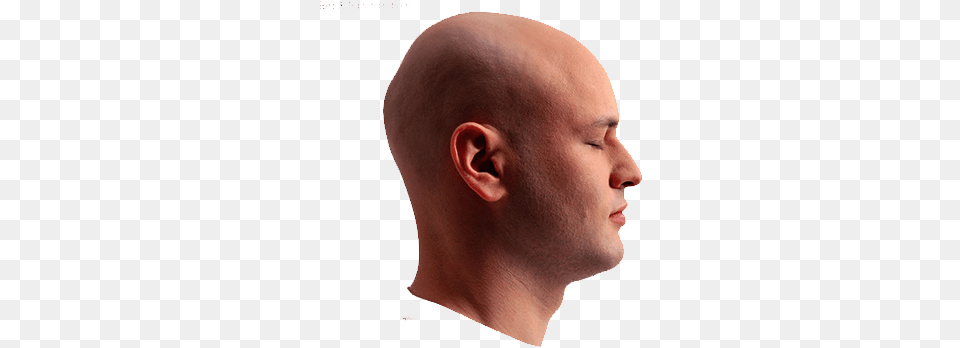 Botak Hair Loss Head Skin Man Side Face 500 Side Face, Adult, Person, Neck, Male Free Png Download