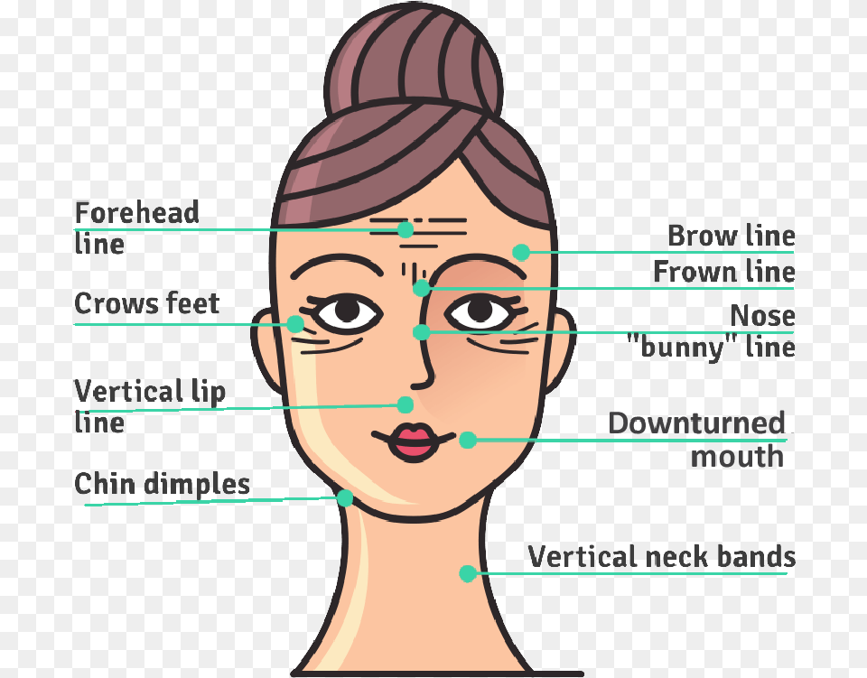 Botox Injection Sites Forehead Brow Forwn Crows Cartoon, Head, Body Part, Person, Face Png