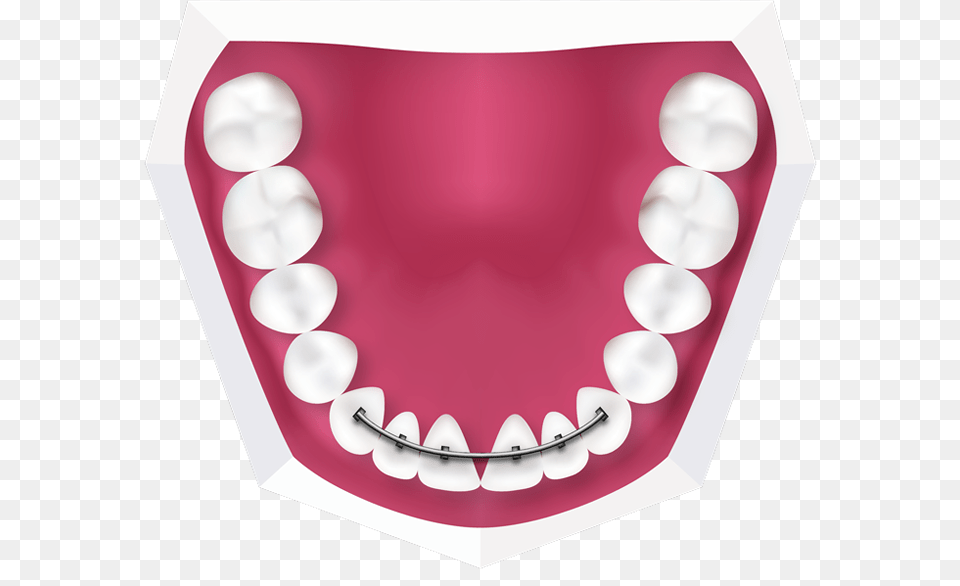 Braces For Kids Richmond London Childrens Orthodontist, Body Part, Face, Head, Mouth Free Transparent Png