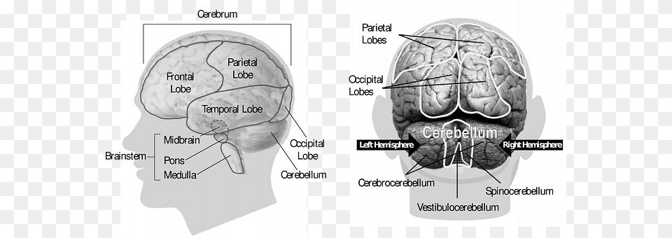 Brain Ammunition, Grenade, Weapon, Ct Scan Free Transparent Png