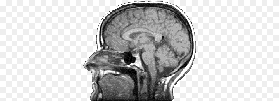 Brain Brain Scan Transparent Background, Ct Scan, Person Png Image