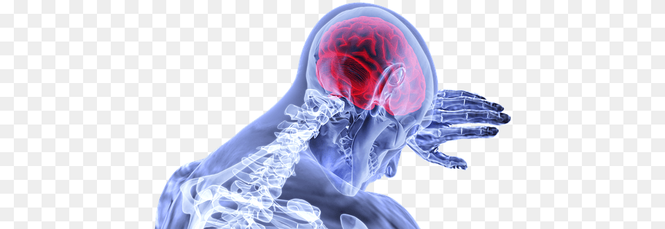 Brain Inflammation Stroke Medical Brain, Adult, Bride, Female, Person Free Png