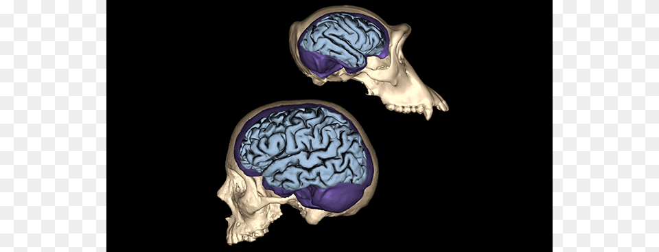 Brain Size Compared To Skull, Ct Scan, Accessories, Jewelry, Locket Png Image