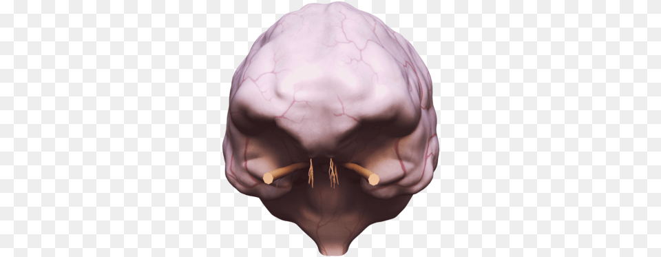 Brain With Dura Mater Skull, Head, Person, Face, Ct Scan Free Transparent Png