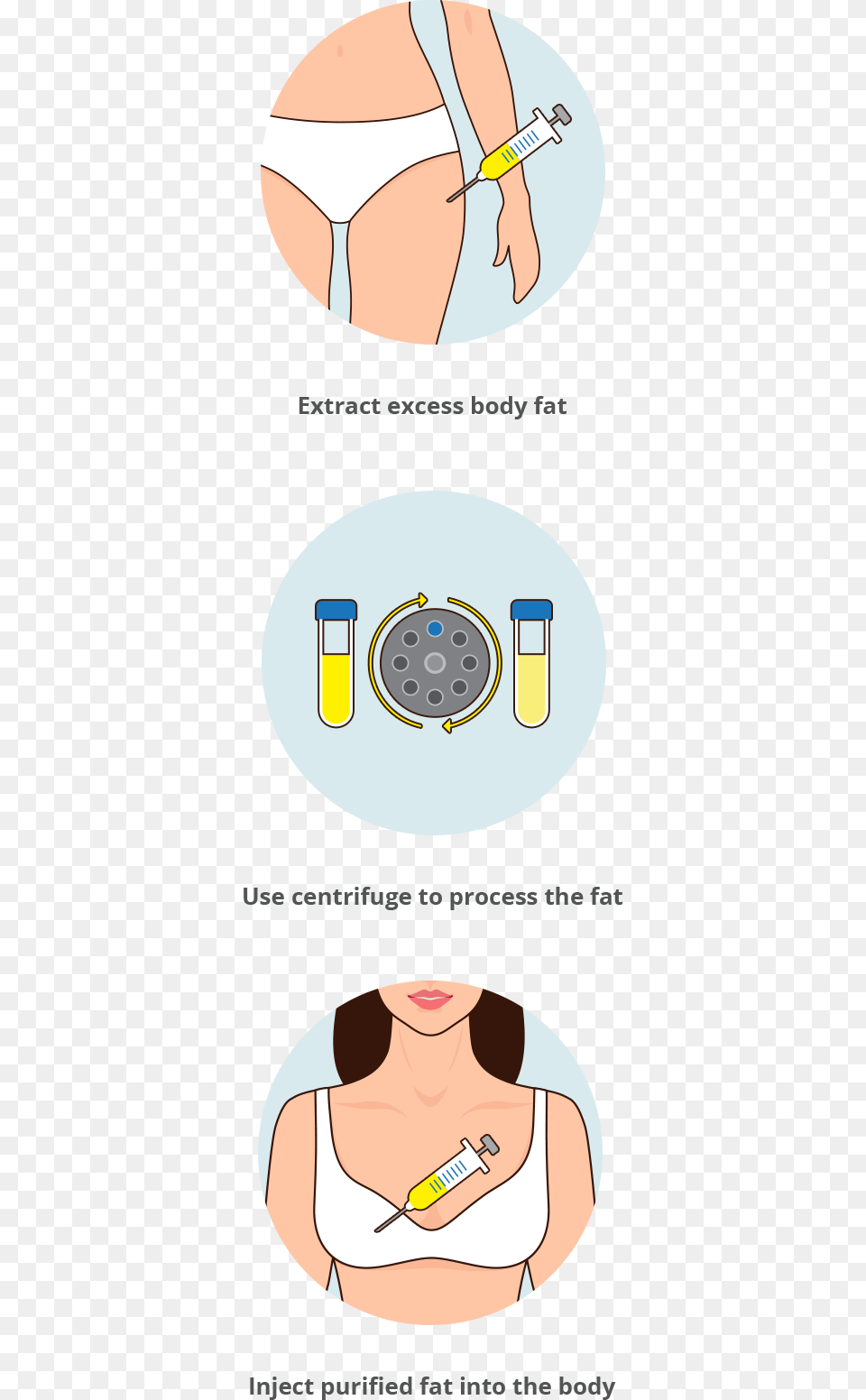 Breast Augmentation Fat Transfer Circle, Adult, Female, Person, Woman Png Image
