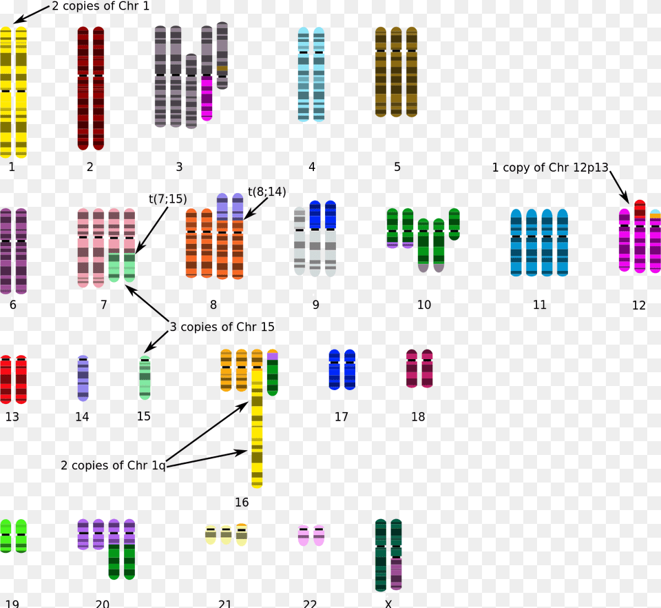 Breast Cancer Cell Karyotype, Art, Architecture, Building Png