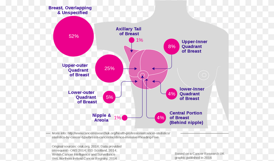Breast Cancer Incidence By Anatomical Site Site Of Breast Cancer, Chart, Plot Png