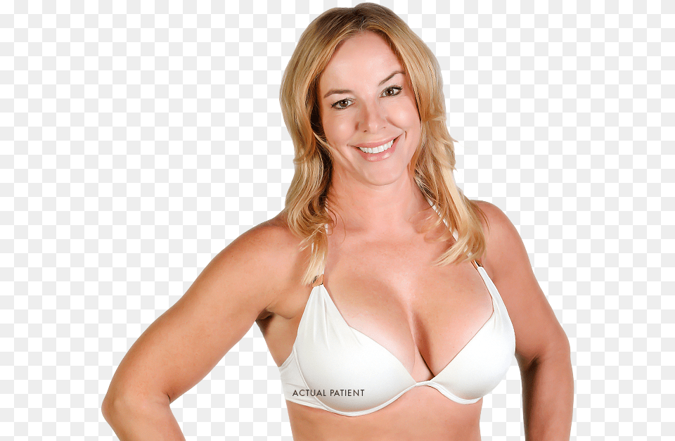 Breast Lift With Implants Model Mastopexy, Adult, Underwear, Swimwear, Person Free Png