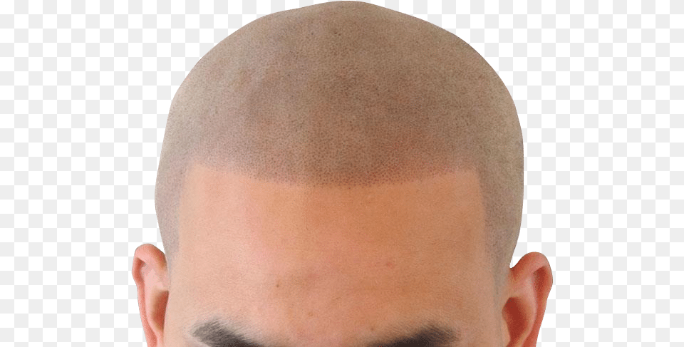 Broken Hairline Buzz Cut, Head, Person, Adult, Face Free Png Download