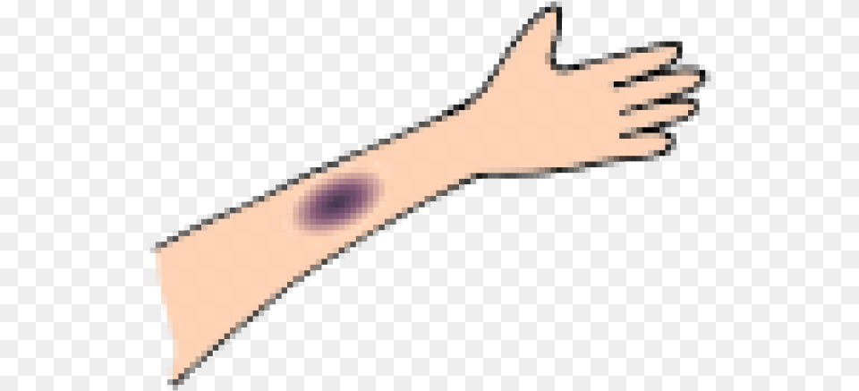 Bruises Cliparts Marking Tools, Arm, Body Part, Hand, Person Free Png Download