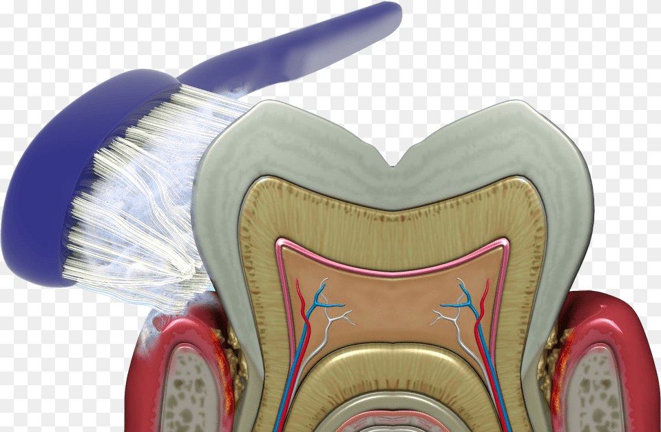 Brushing Rinsing And Flossing Cannot Reach The Bacteria Gingival And Periodontal Pocket, Cushion, Home Decor, Furniture, Chair Free Png Download