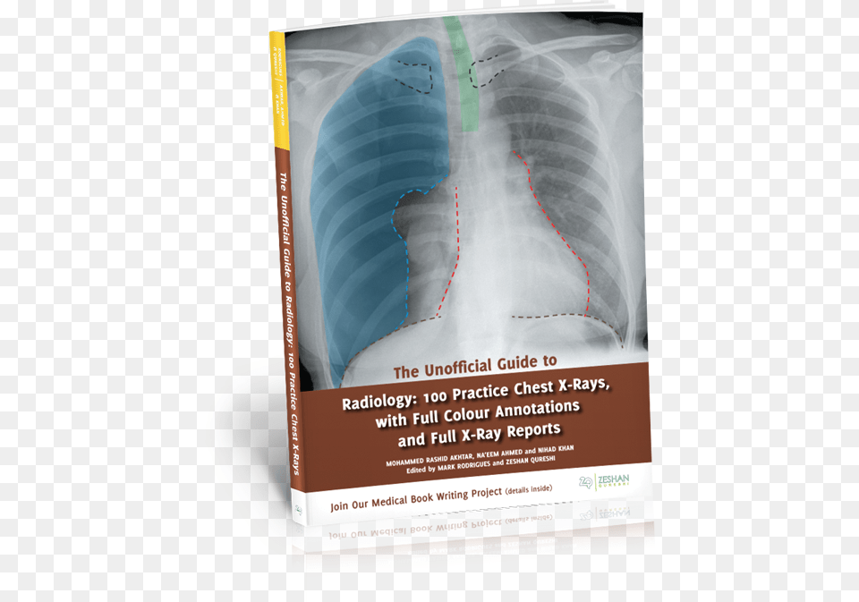 Buy The Unofficial Guide To Radiology Unofficial Guide To Radiology 100 Practice Chest X Rays, Advertisement, Ct Scan, Poster Free Png Download