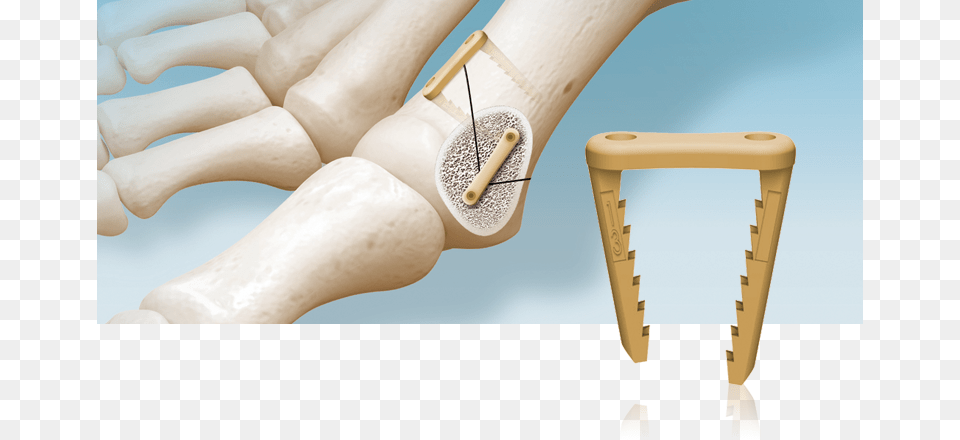 C Staple Chair, Baby, Person, Clothing, Footwear Free Png Download