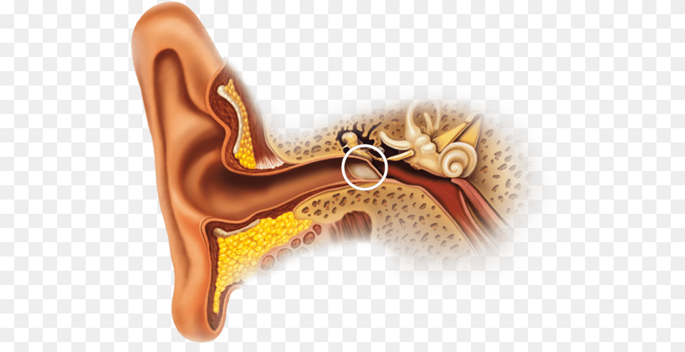 Calcification Of Ear Canal, Body Part, Accessories, Adult, Female Png Image