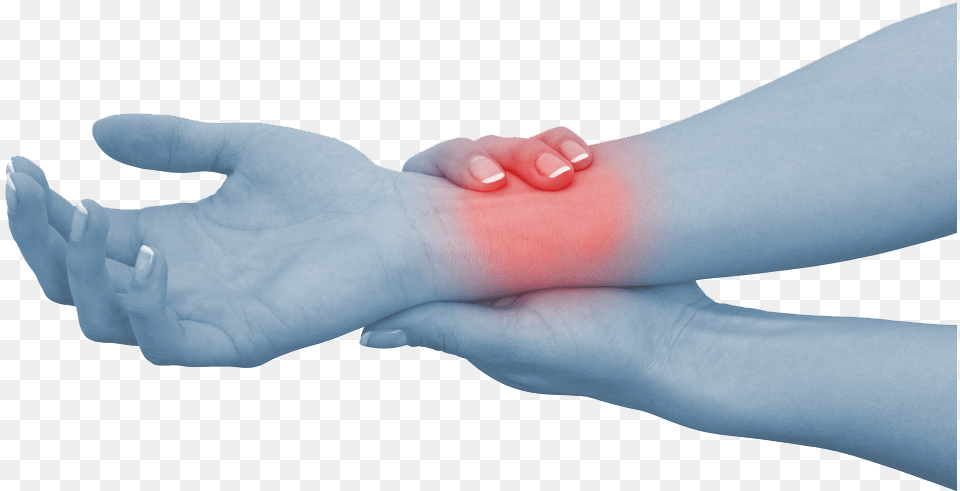Carpal Tunnel Syndrome Causes Symptoms Amp Treatment Carpal Tunnel Syndrome, Body Part, Hand, Person, Wrist Png
