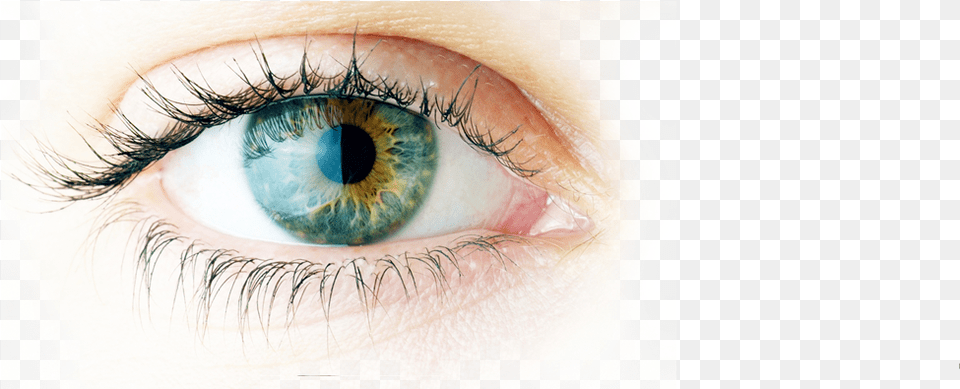 Cataract Eye Surgery In New Jersey Imagenes Sobre El Ojo, Contact Lens, Person, Face, Head Free Png
