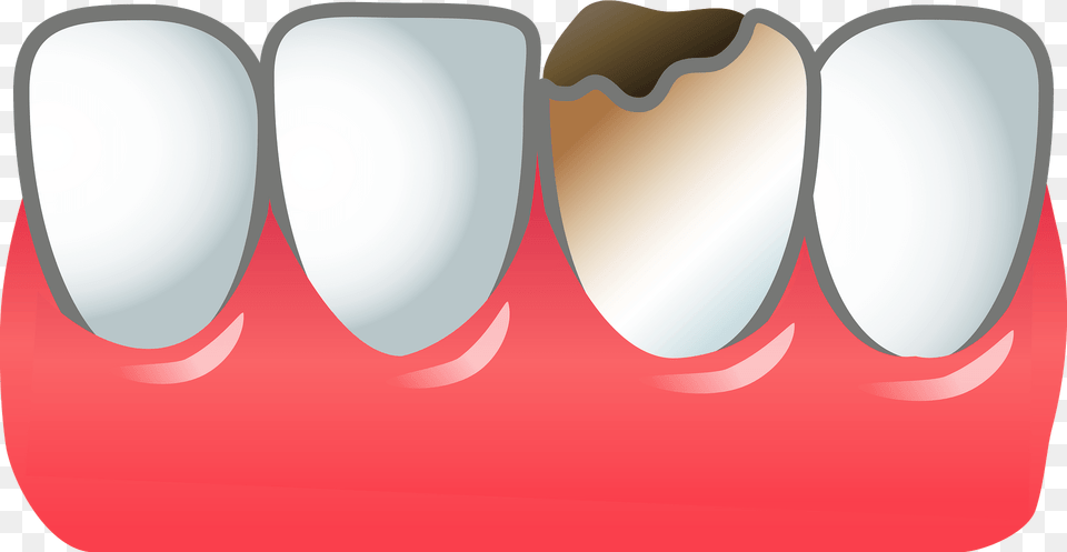 Cavity Tooth Decay Clipart, Body Part, Mouth, Person, Teeth Png Image