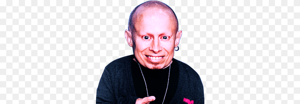 Cdi Verne Troyer Hair Loss, Accessories, Adult, Body Part, Finger Png Image