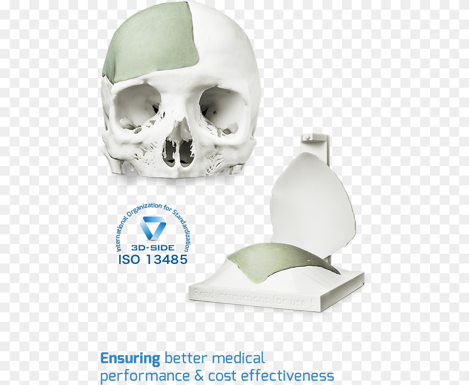 Cement Cranial Implant Skull, Advertisement, Baby, Person Png