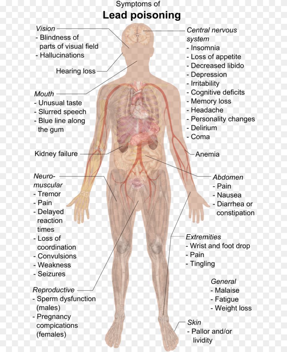 Center Nervous System Luxury File Symptoms Of Lead Lead Poisoning Symptoms, Adult, Male, Man, Person Free Png