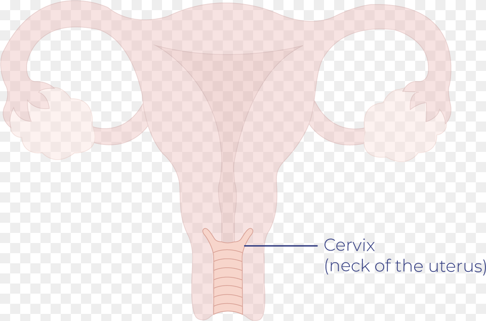 Cervical Cancer Talk Peach Cartoon, Baby, Person, Chart, Plot Free Transparent Png
