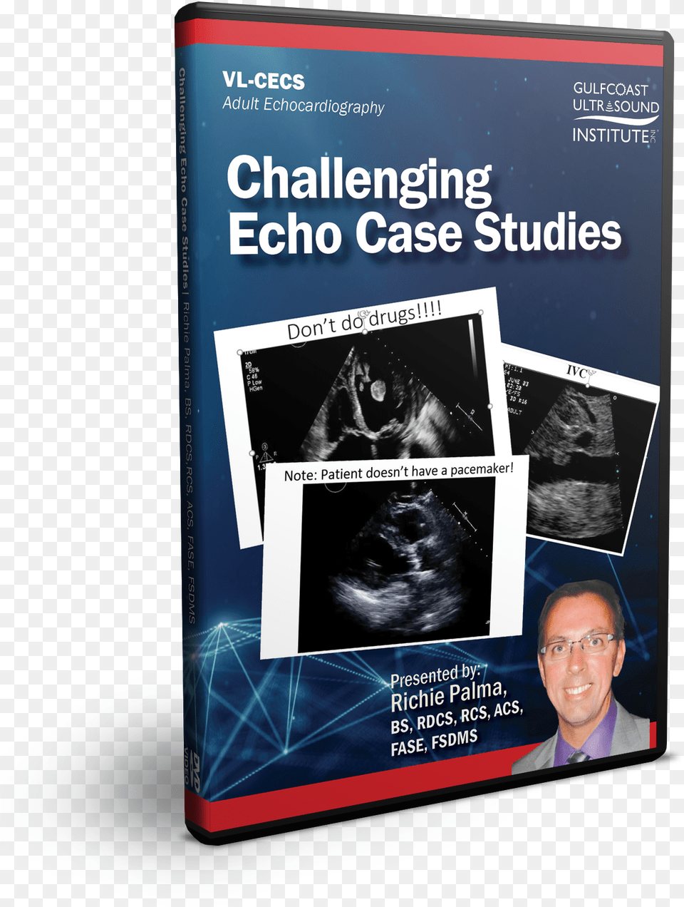 Challenging Echo Case Studies Novel, Publication, Book, Advertisement, Poster Png Image