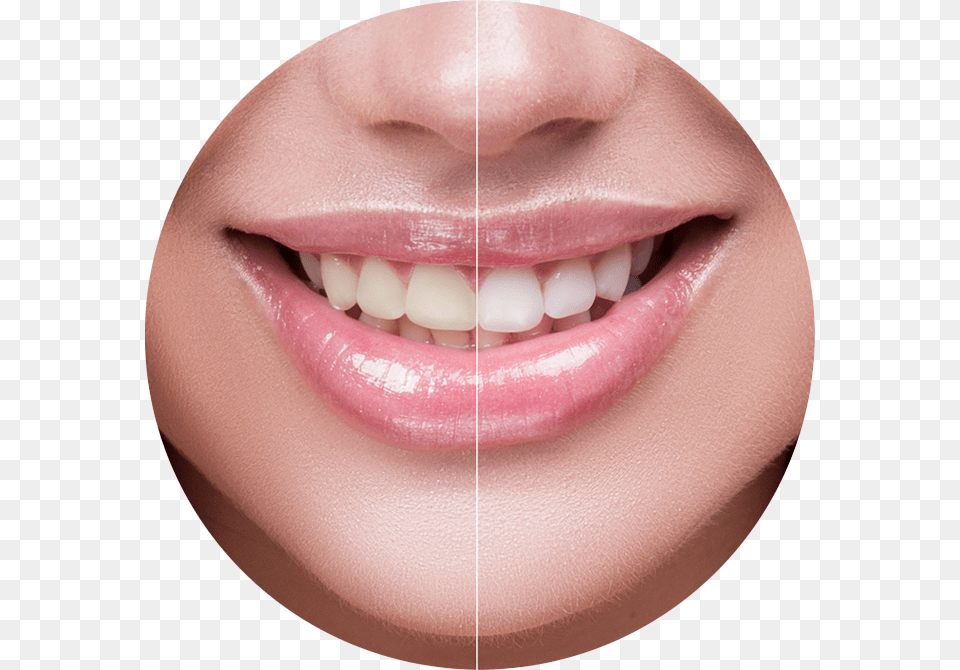 Charcoal Blast Teeth Whitening Powder Reviews, Body Part, Mouth, Person, Adult Free Png Download