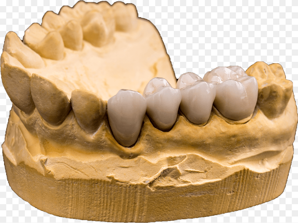 Check Out What Others Are Saying About Our Dental Crown Ceramic, Teeth, Body Part, Person, Mouth Png
