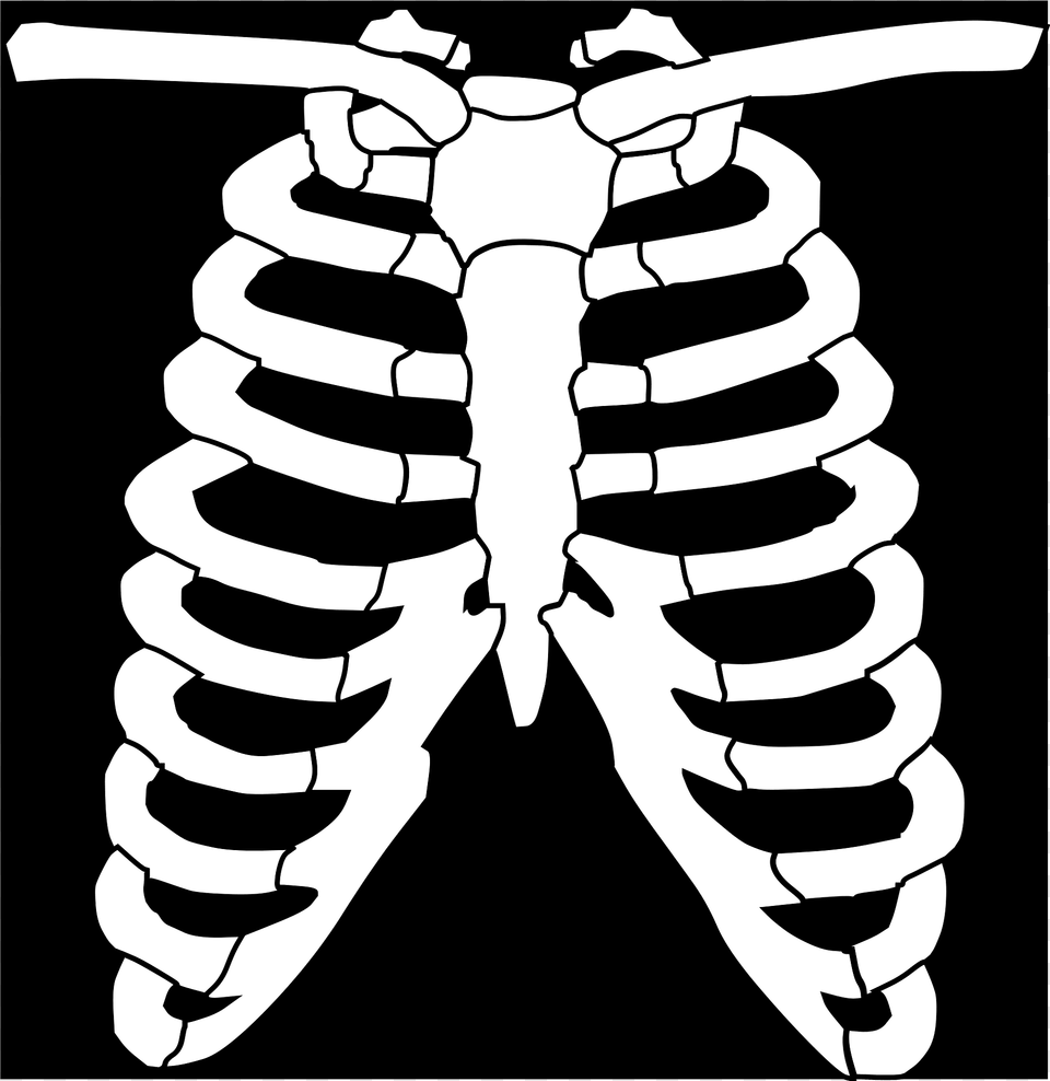 Chest Clipart Free Transparent Png