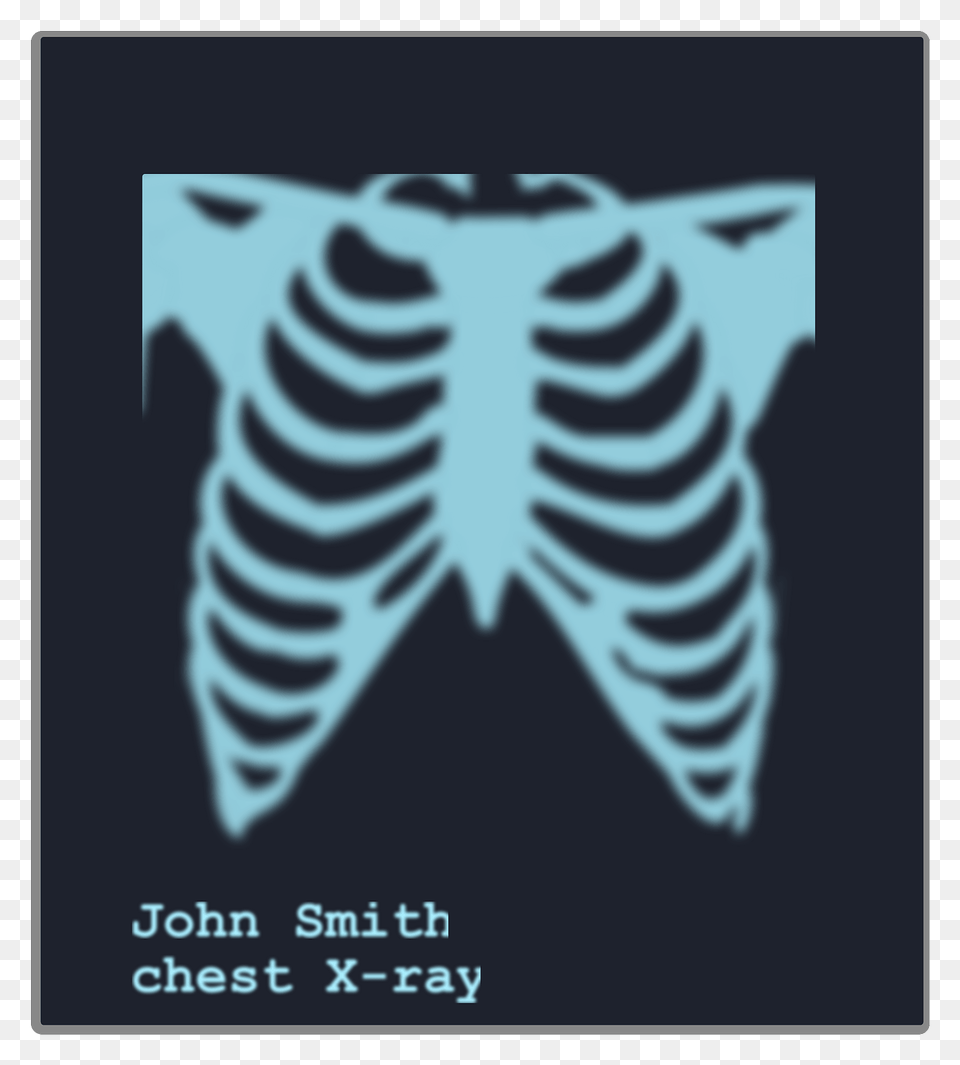 Chest X Ray Image Clipart Free Png Download