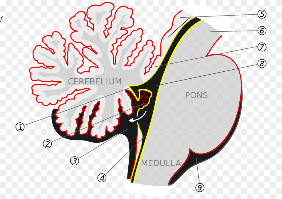 Choroid Plexus, Ct Scan, Bow, Weapon Png