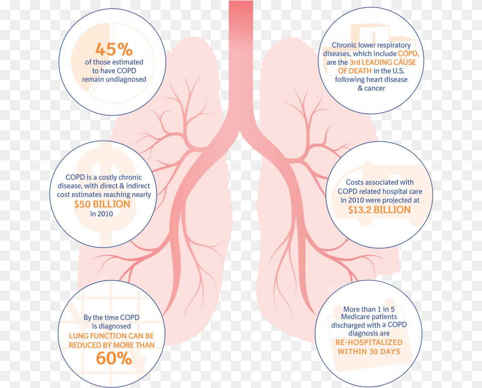 Chronic Lung Disease Statistics Chronic Obstructive Pulmonary Disease Infographics, Face, Head, Person, Baby Free Png Download