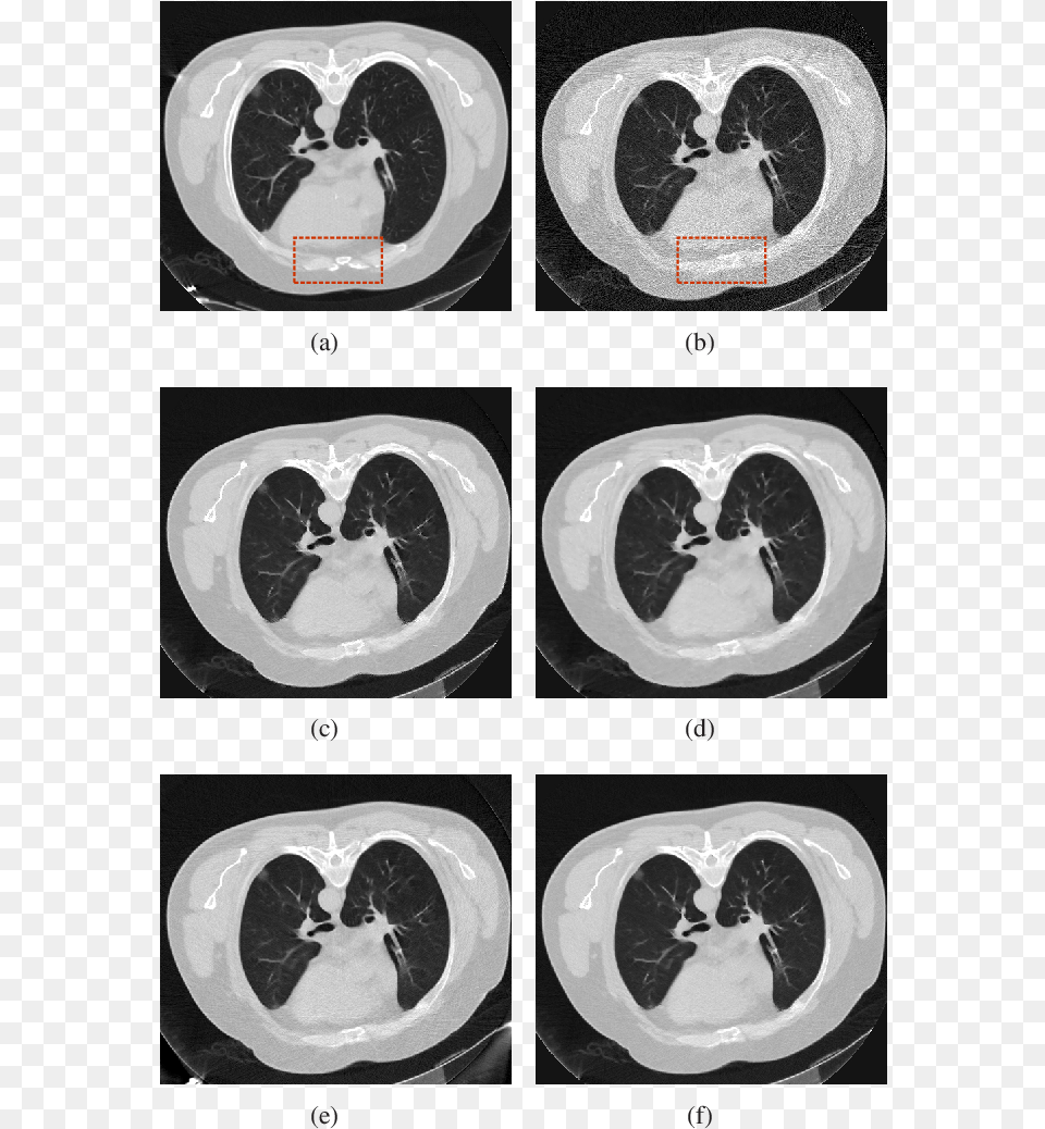 Circle, Ct Scan, Tape Png