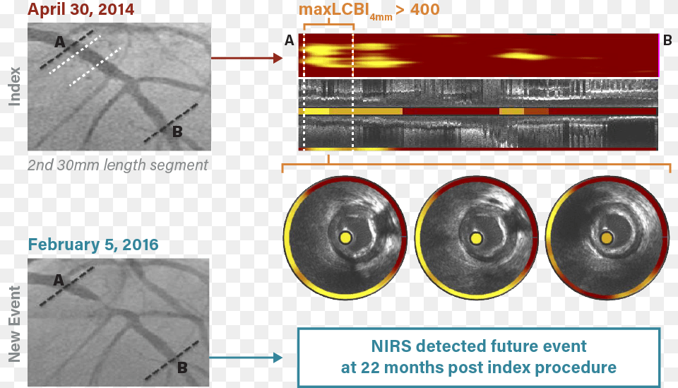 Circle, Chart, Plot, Ct Scan Png