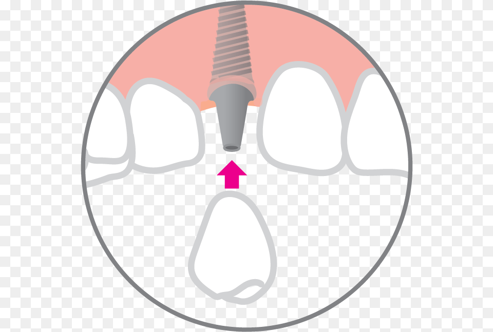 Circle, Body Part, Mouth, Person, Teeth Free Png