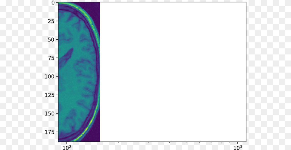 Circle, Ct Scan, Oval, Tennis Racket, Tennis Png Image