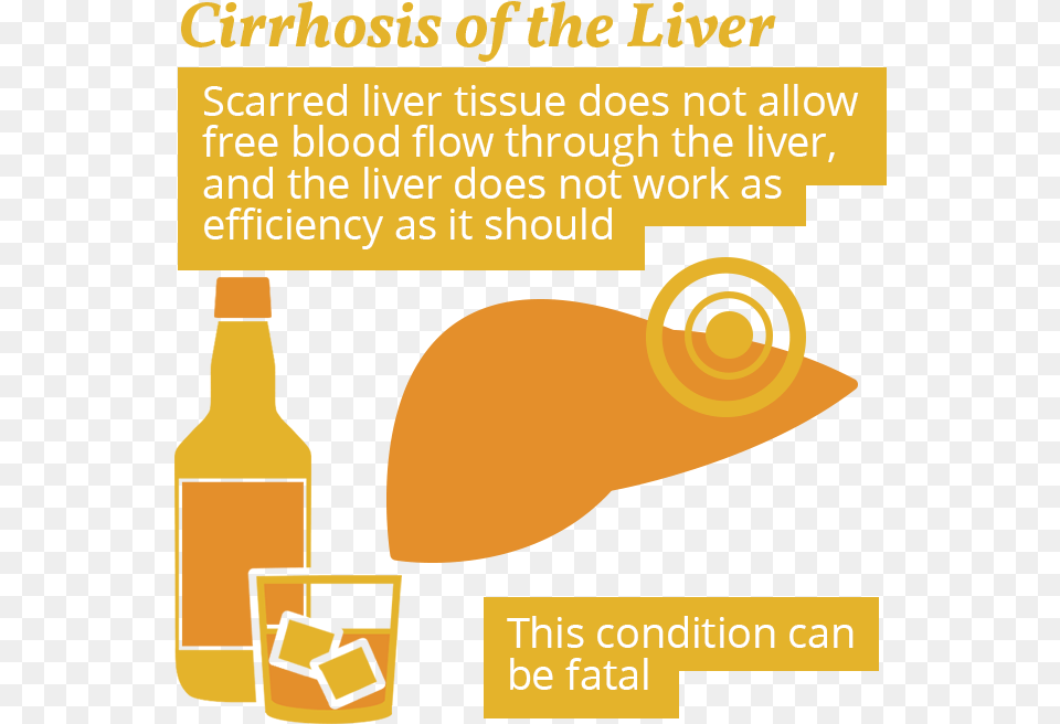 Cirrhosis And Alcohol Use, Beer, Beverage, Bottle, Liquor Free Png